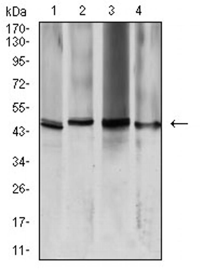 Aquaporin 2 Antibody in Western Blot (WB)