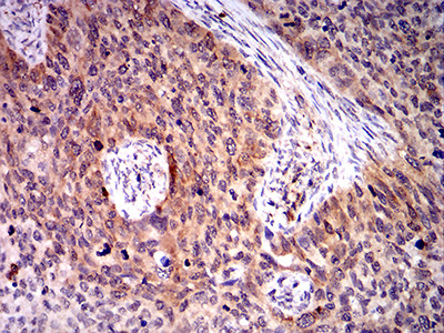 BIN1 Antibody in Immunohistochemistry (Paraffin) (IHC (P))