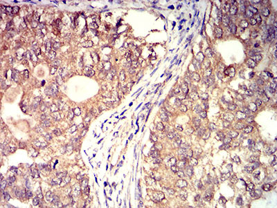 BTN2A2 Antibody in Immunohistochemistry (Paraffin) (IHC (P))