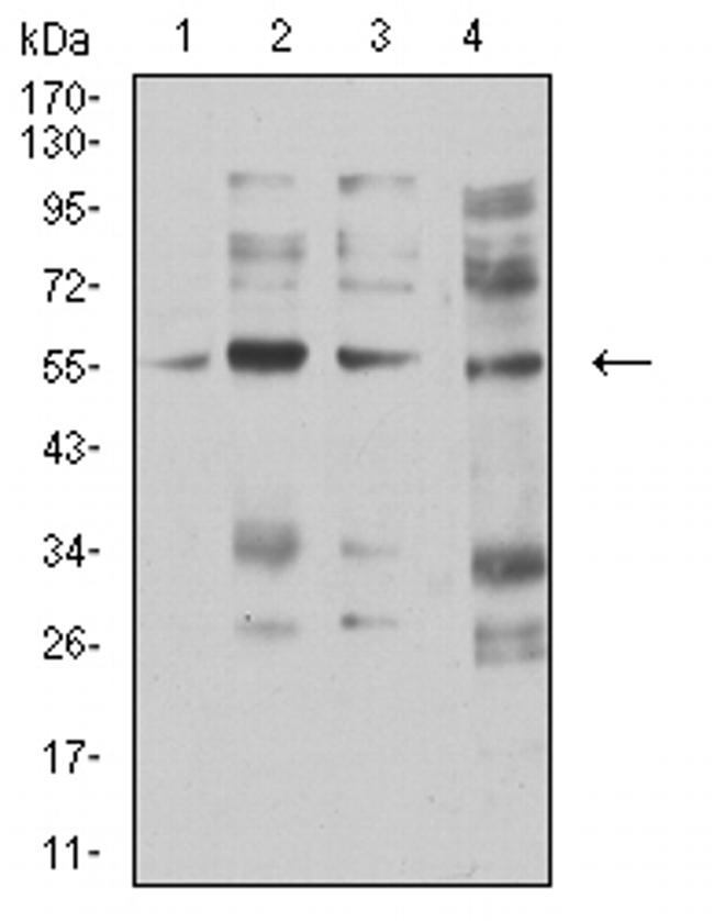 CHRNA5 Antibody in Western Blot (WB)