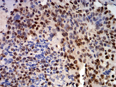 CIRBP Antibody in Immunohistochemistry (Paraffin) (IHC (P))