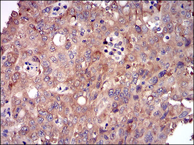 DIS3L2 Antibody in Immunohistochemistry (Paraffin) (IHC (P))