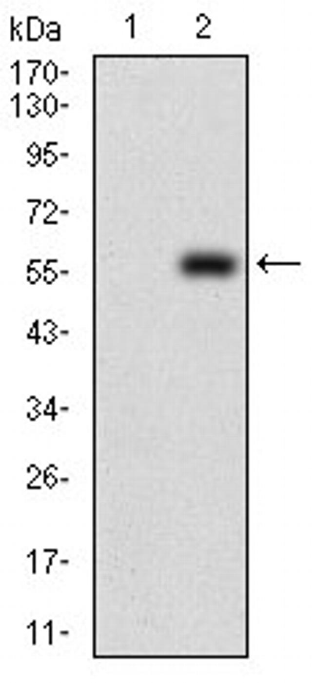 DIS3L2 Antibody in Western Blot (WB)