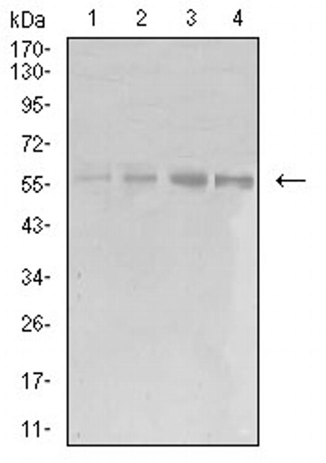 eIF5 Antibody in Western Blot (WB)