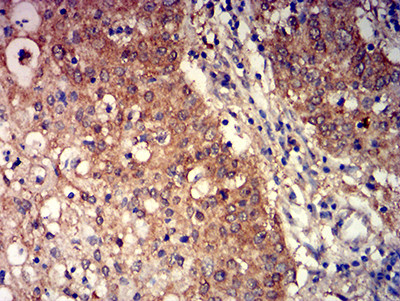 mGluR3 Antibody in Immunohistochemistry (Paraffin) (IHC (P))