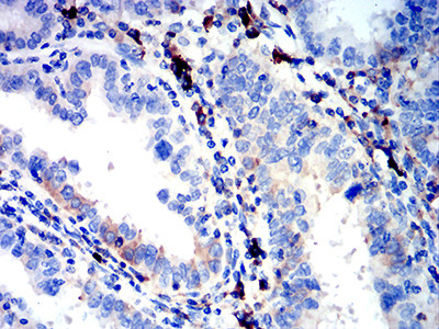 IGLC2 Antibody in Immunohistochemistry (Paraffin) (IHC (P))