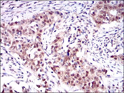ONECUT3 Antibody in Immunohistochemistry (Paraffin) (IHC (P))