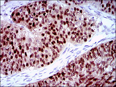 PLAGL1 Antibody in Immunohistochemistry (Paraffin) (IHC (P))