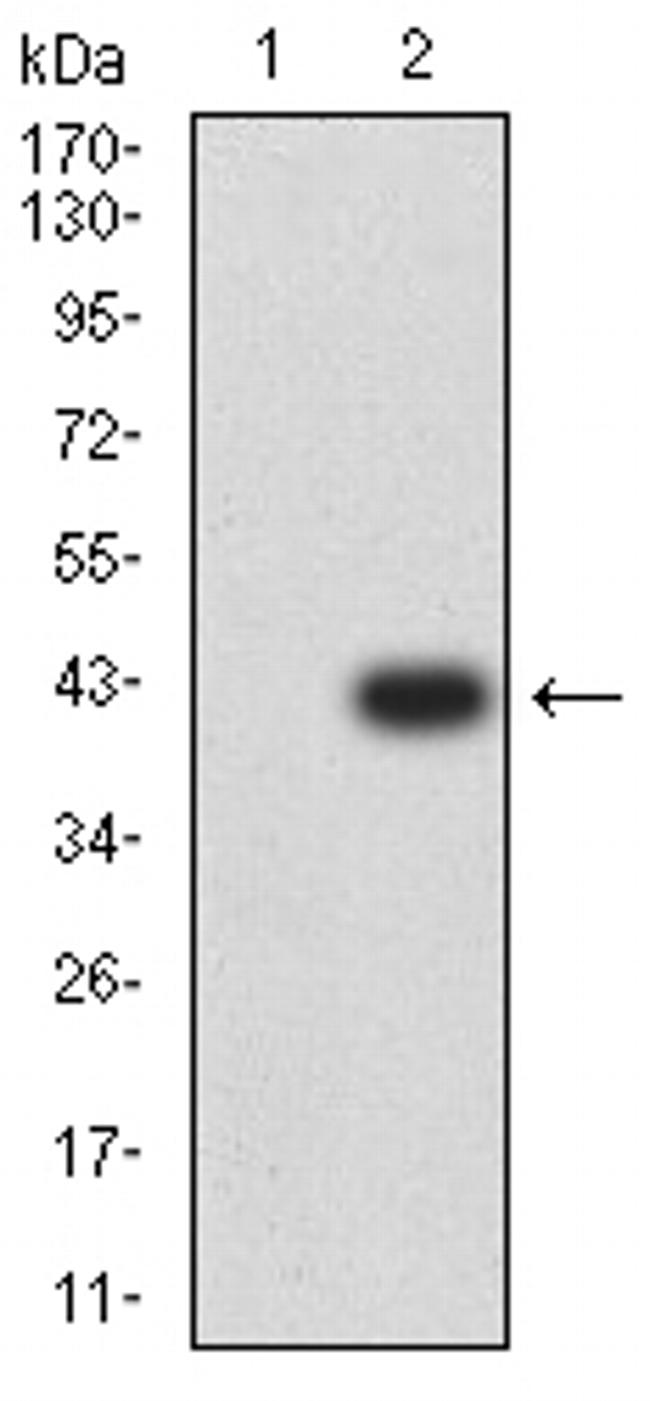 RIPK4 Antibody in Western Blot (WB)