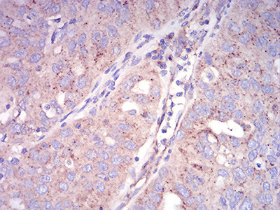 SEC31A Antibody in Immunohistochemistry (Paraffin) (IHC (P))