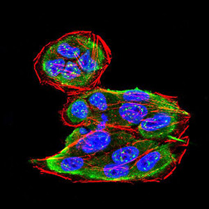 SPHK2 Antibody in Immunocytochemistry (ICC/IF)