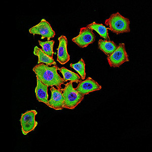 UCP3 Antibody in Immunocytochemistry (ICC/IF)