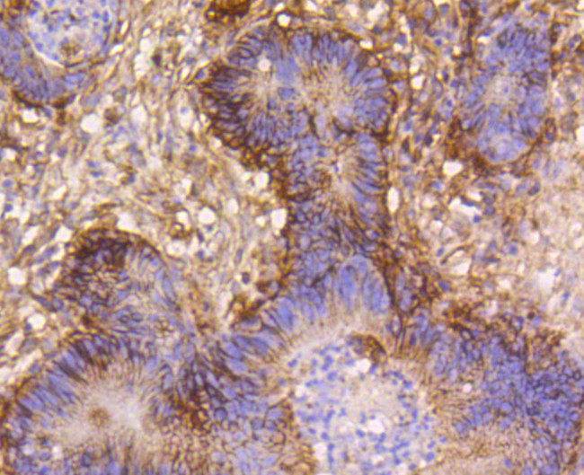 Integrin beta 1 (CD29) Antibody in Immunohistochemistry (Paraffin) (IHC (P))