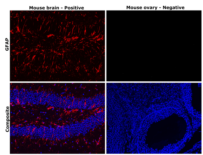 GFAP Antibody in Immunohistochemistry (Paraffin) (IHC (P))