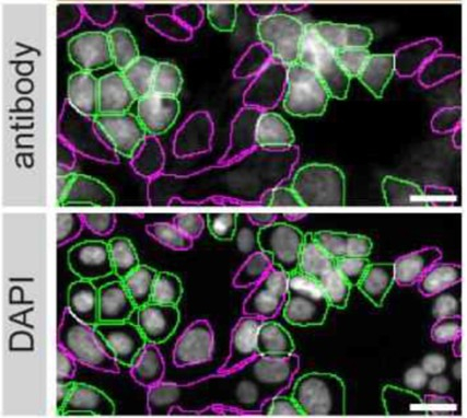 CDK5 Antibody in Immunocytochemistry (ICC/IF)