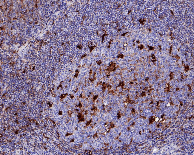 MERTK Antibody in Immunohistochemistry (Paraffin) (IHC (P))
