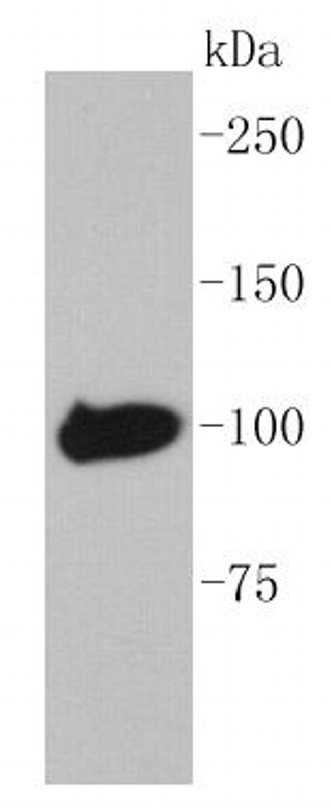 Maltose Binding Protein Antibody in Western Blot (WB)