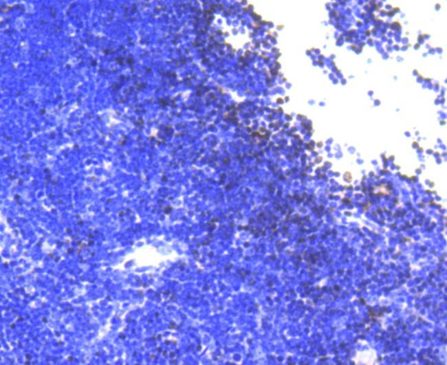 SATB1 Antibody in Immunohistochemistry (Paraffin) (IHC (P))