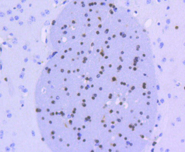 OLIG2 Antibody in Immunohistochemistry (Paraffin) (IHC (P))