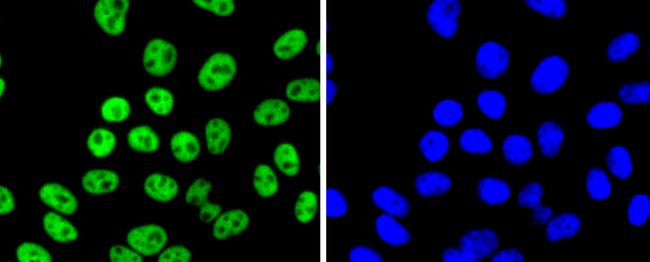 FUBP1 Antibody in Immunocytochemistry (ICC/IF)