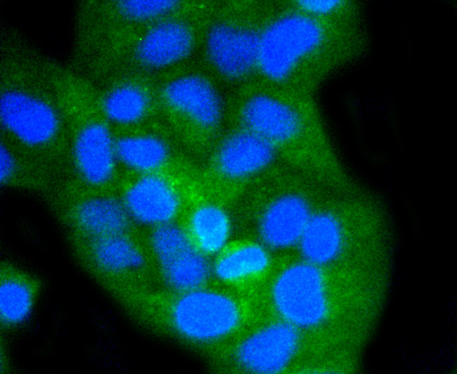 CD8 alpha Antibody in Immunocytochemistry (ICC/IF)