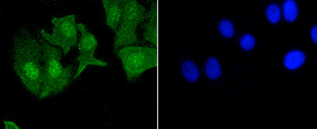 Phospho-EGFR (Tyr1092) Antibody in Immunocytochemistry (ICC/IF)