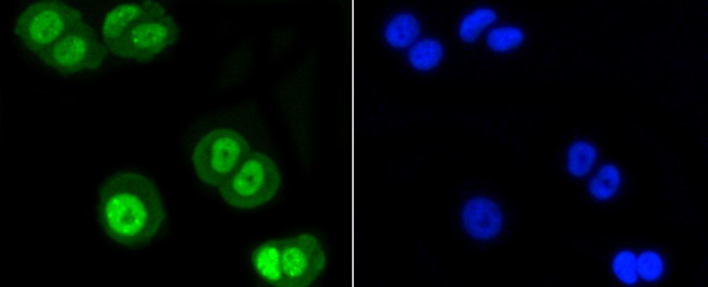 SUMO1 Antibody in Immunocytochemistry (ICC/IF)