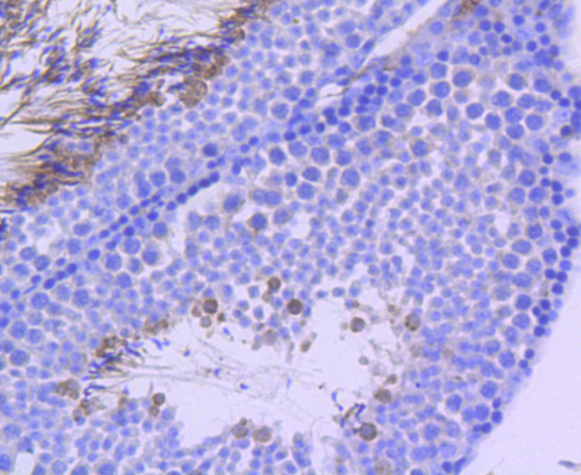 Phospho-NBS1 (Ser343) Antibody in Immunohistochemistry (Paraffin) (IHC (P))