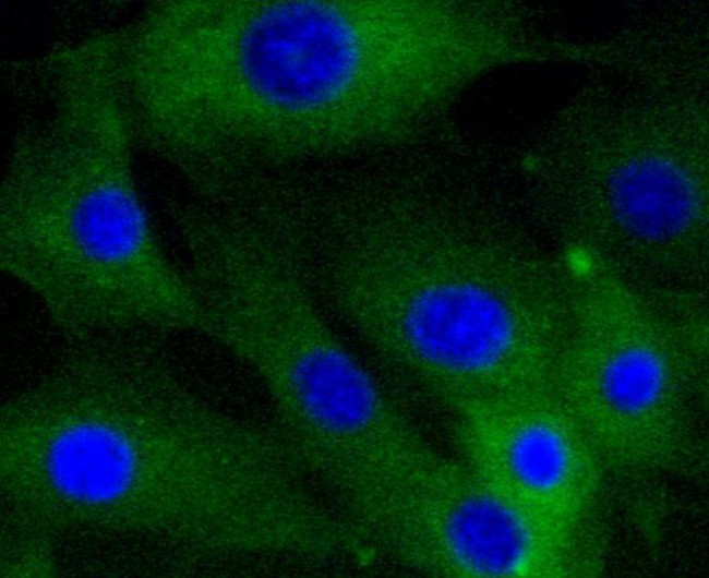 Caldesmon Antibody in Immunocytochemistry (ICC/IF)