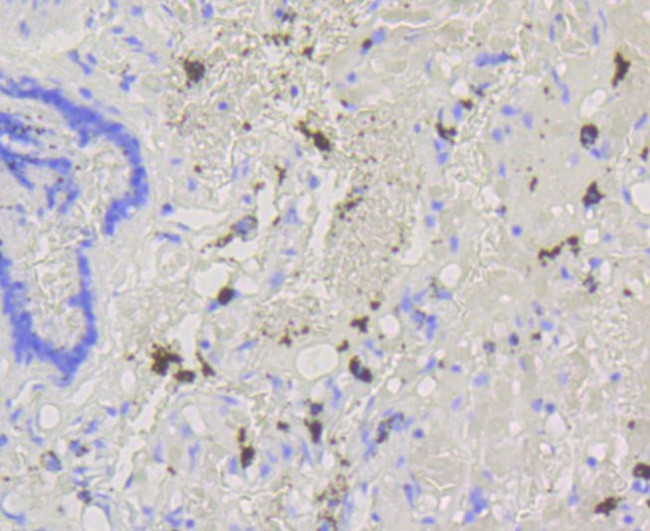 ABCG1 Antibody in Immunohistochemistry (Paraffin) (IHC (P))
