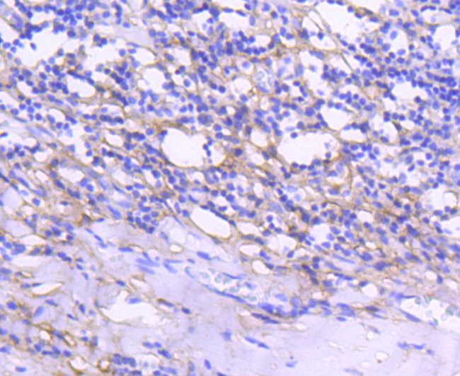 Tenascin C Antibody in Immunohistochemistry (Paraffin) (IHC (P))