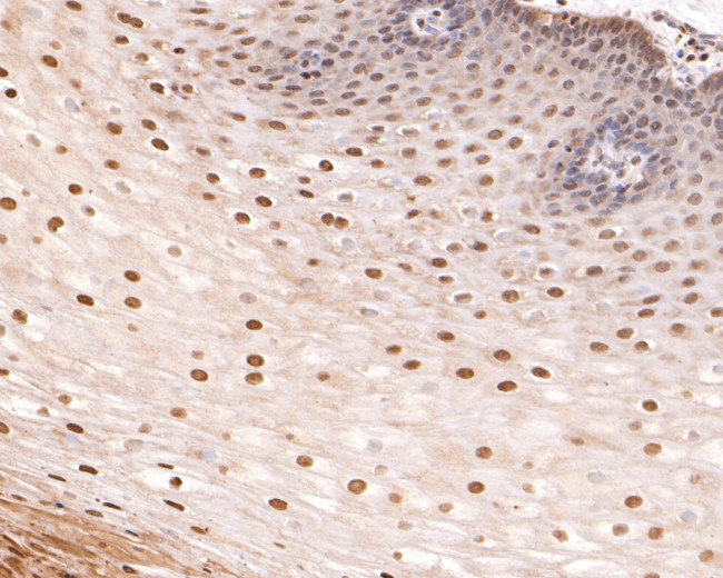 Phospho-p53 (Thr55) Antibody in Immunohistochemistry (Paraffin) (IHC (P))