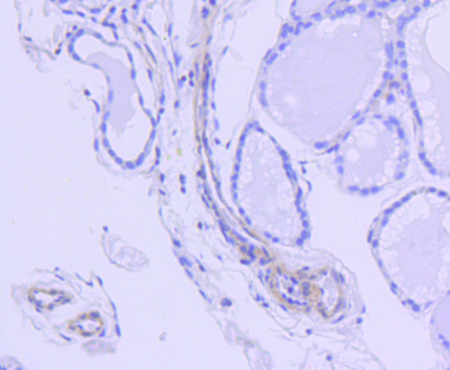 ROCK1 Antibody in Immunohistochemistry (Paraffin) (IHC (P))