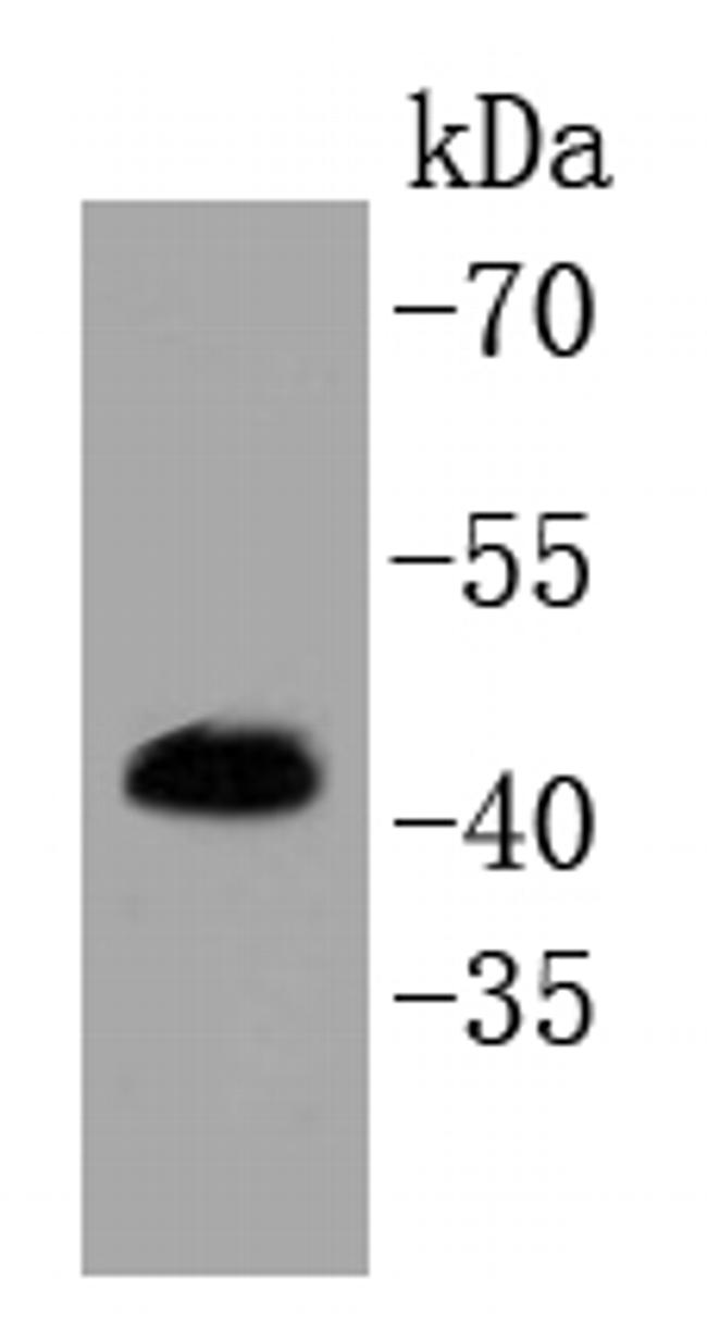 Phospho-ERK1/ERK2 (Thr202, Tyr204, Thr185, Tyr187) Antibody in Western Blot (WB)