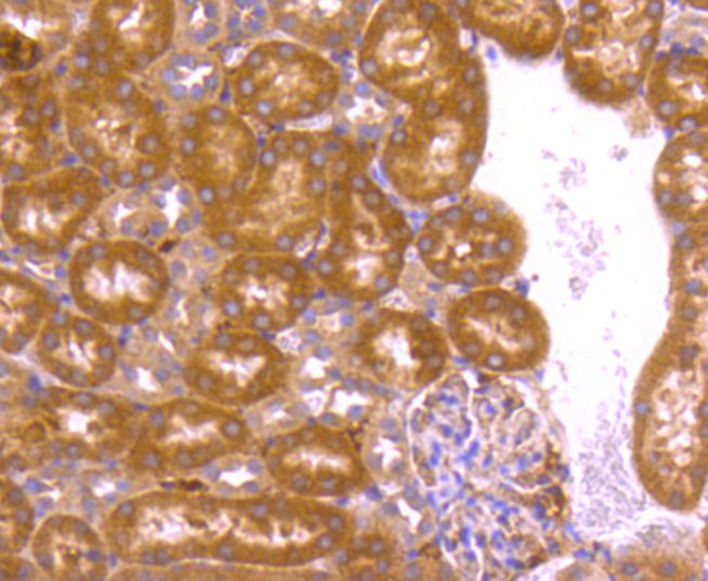 BCL2A1 Antibody in Immunohistochemistry (Paraffin) (IHC (P))