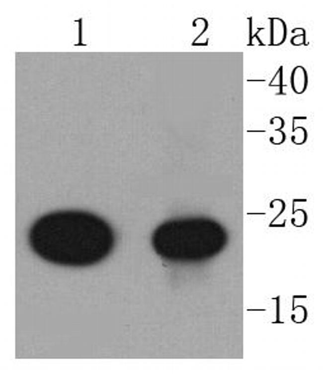 AKAP14 Antibody in Western Blot (WB)