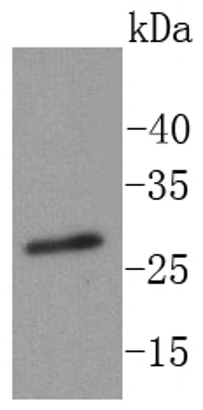 Phospho-RPA2 (Thr21) Antibody in Western Blot (WB)