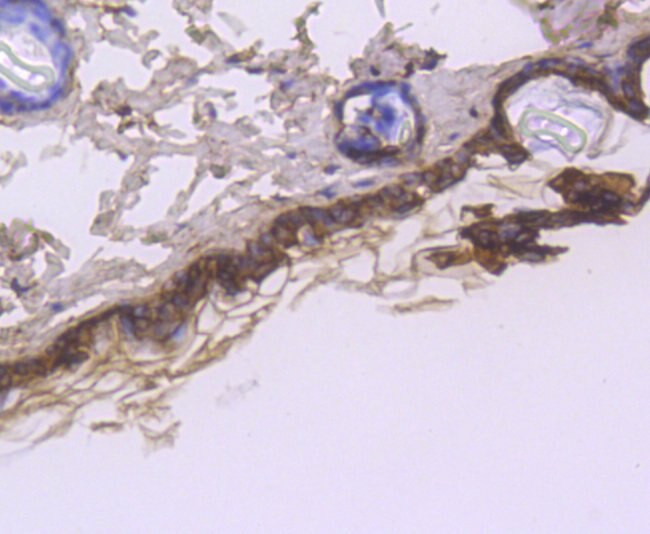 Cytokeratin 1 Antibody in Immunohistochemistry (Paraffin) (IHC (P))