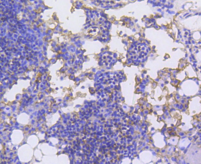 LSP1 Antibody in Immunohistochemistry (Paraffin) (IHC (P))