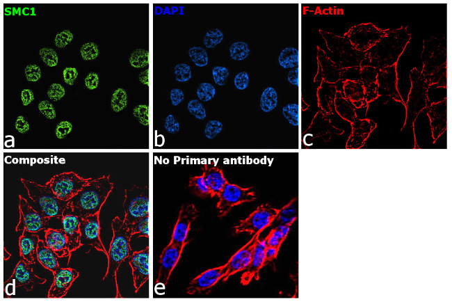 SMC1 Antibody in Immunocytochemistry (ICC/IF)