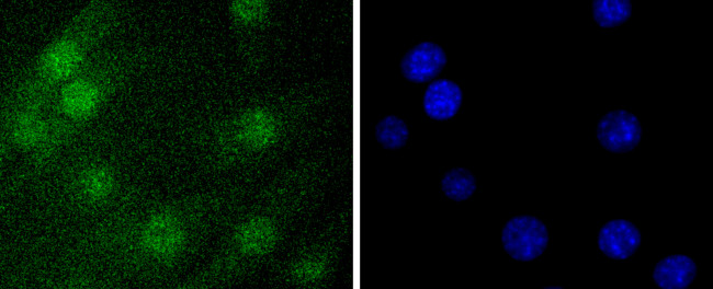 Histone 1F0 Antibody in Immunocytochemistry (ICC/IF)