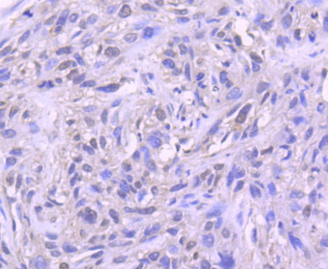Histone 1F0 Antibody in Immunohistochemistry (Paraffin) (IHC (P))