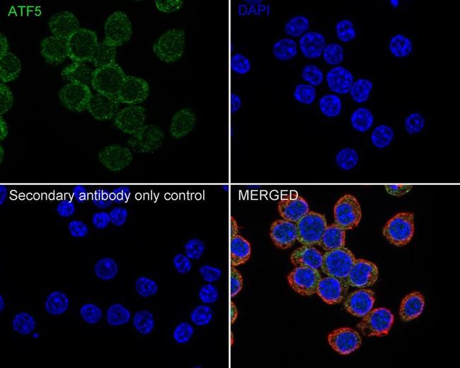 ATF5 Antibody in Immunocytochemistry (ICC/IF)