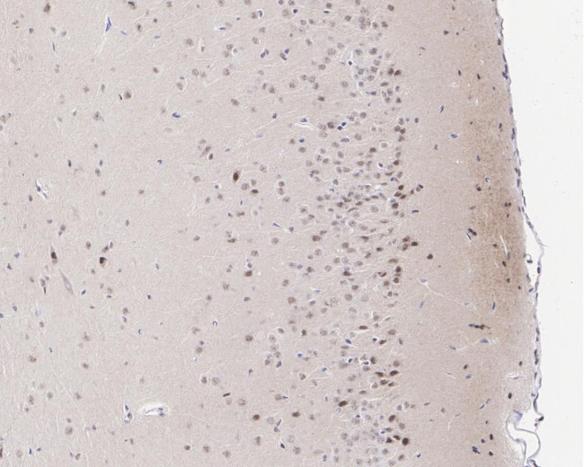 Phospho-MEK1 (Thr292) Antibody in Immunohistochemistry (Paraffin) (IHC (P))