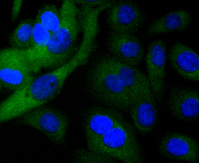 TRK fused gene Antibody in Immunocytochemistry (ICC/IF)