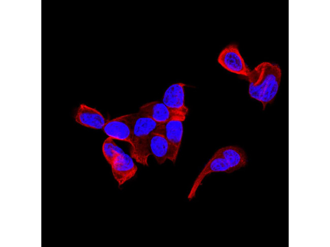 KRT9 Antibody in Immunocytochemistry (ICC/IF)
