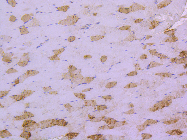 HSP20 Antibody in Immunohistochemistry (Paraffin) (IHC (P))