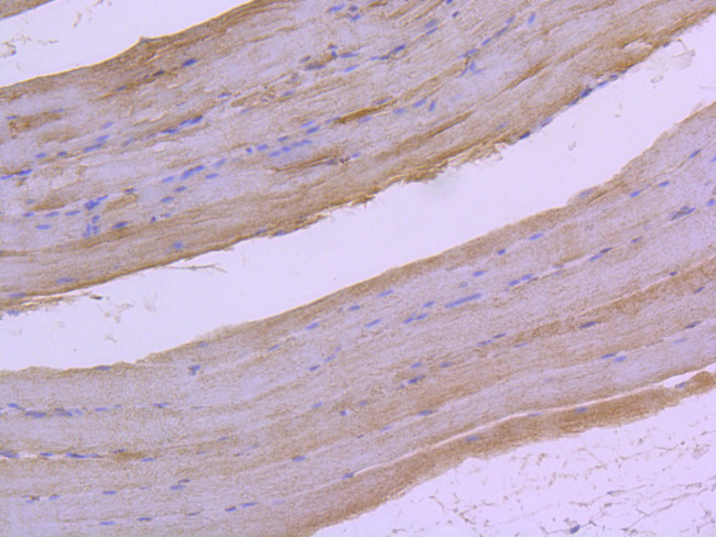 Phospho-c-Raf (Ser259) Antibody in Immunohistochemistry (Paraffin) (IHC (P))