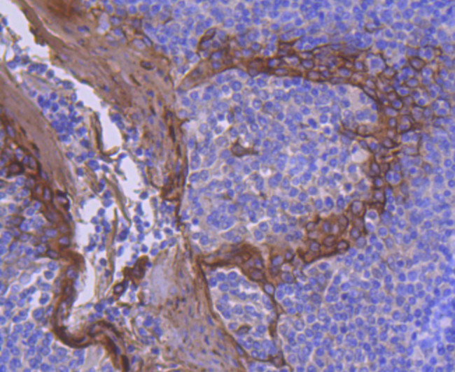Cytokeratin 2e Antibody in Immunohistochemistry (Paraffin) (IHC (P))