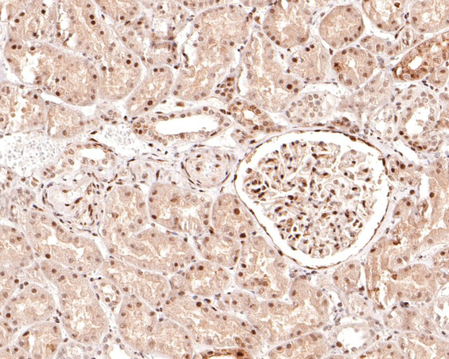 Phospho-c-Raf (Ser621) Antibody in Immunohistochemistry (Paraffin) (IHC (P))